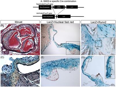 Role of Runx2 in Calcific Aortic Valve Disease in Mouse Models